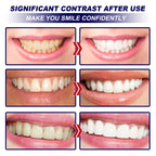 Bandes Blanchissantes Dentaires Express | Sourire Éclatant |AvryStyle
