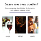 Bandes Blanchissantes Dentaires Express | Sourire Éclatant |AvryStyle